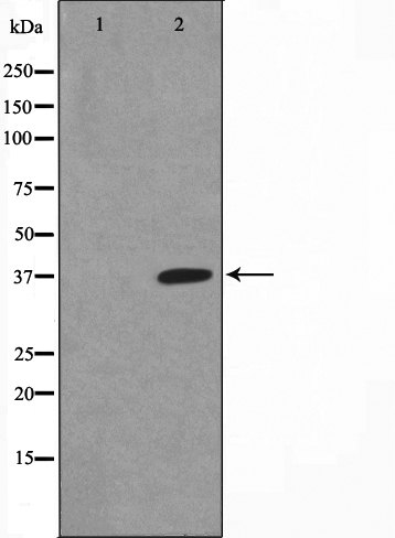 Phospho-IKB alpha (Ser32/Ser36) Antibody