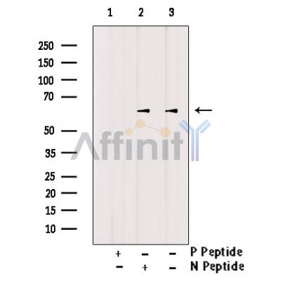 Phospho-CTDSPL2 (Ser104) Antibody