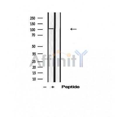 Phospho-Dab1 (Tyr220) Antibody