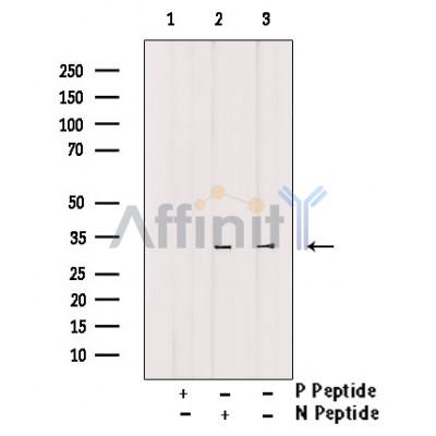 Phospho-DARPP32 (Ser97)[Ser102] Antibody 