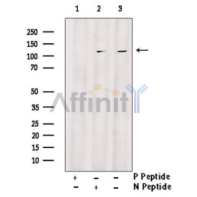 Phospho-DDR1 (Tyr513) Antibody