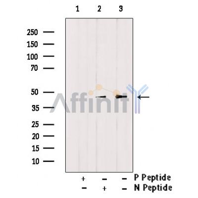 Phospho-Doublecortin (Ser297) Antibody
